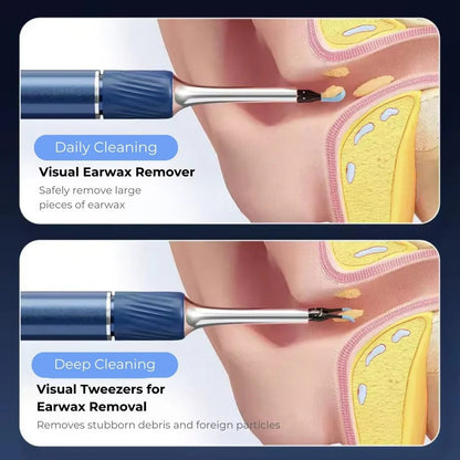 Smart Wireless Ear Cleaner with 4K Camera (Android / iOS)